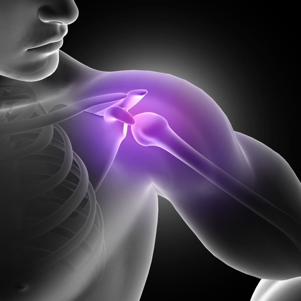 Shoulder Pain Stromal Vascular Fraction — TOSM Delray Beach