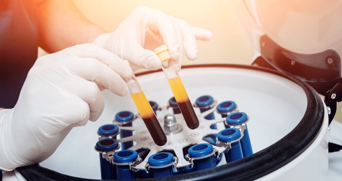 PRP Shoulder Injection in Delray Beach: What Patients Should Know Before Scheduling Gloved clinician loading blood tubes with separated platelet-rich plasma into a centrifuge to prepare a PRP shoulder injection at Tyrance Orthopedics in Delray Beach.