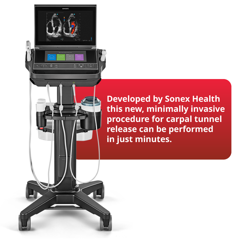 Ultrasound-Guided Carpal Tunnel Release — Delray Beach UltraGuideCTR device for ultrasound-guided carpal tunnel release at TOSM, Delray Beach, FL